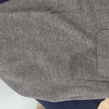 Defolu Ürünler Ve Uzun İade Süresi Nedeniyle Hızlı Geri Ödeme Talebi