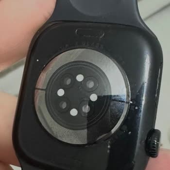 Apple Watch Kasa Boya Atması Ve Sensör Soyulması Garanti Dışı Bırakıldı