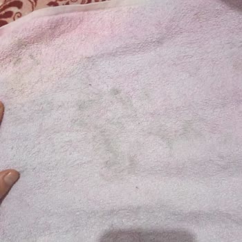 Garanti Süresi İçindeki Çamaşır Makinesinde Lekeli Yıkama Sorunu Ve Çözüm Talebi