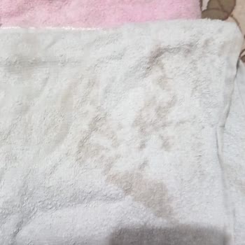 Garanti Süresi İçindeki Çamaşır Makinesinde Lekeli Yıkama Sorunu Ve Çözüm Talebi