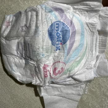 Molfix Bebek Bezinde Sert Keskin Cisim Güvenlik Ve Hijyen İhlali