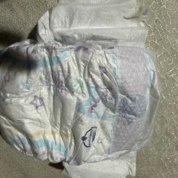 Molfix Bebek Bezinde Sert Keskin Cisim Güvenlik Ve Hijyen İhlali