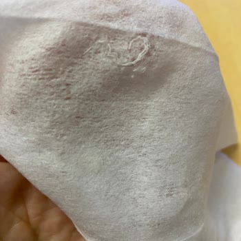 Sleepy Islak Bebek Havlusunda Plastik Yabancı Madde Bulunması Güven Ve Hijyen Sorunu