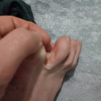 Fazla Ücret Ve Ayak Yaralanmasına Neden Olan Ayıplı Ayakkabı Şikayeti