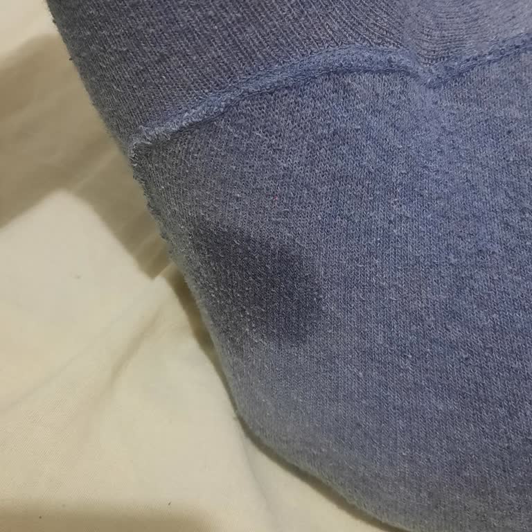 Sleepy Bebek Bezlerinde Sızdırma Ve Pişik Sorunu