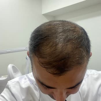 Elzen Beauty | Çorum Üç Seanstır Randevu Sürecinde Ciddi Sıkıntı Yaşıyorum