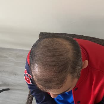 Elzen Beauty | Çorum Üç Seanstır Randevu Sürecinde Ciddi Sıkıntı Yaşıyorum