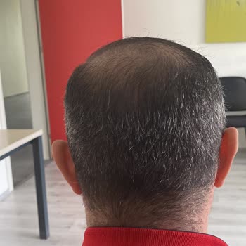 Elzen Beauty | Çorum Üç Seanstır Randevu Sürecinde Ciddi Sıkıntı Yaşıyorum