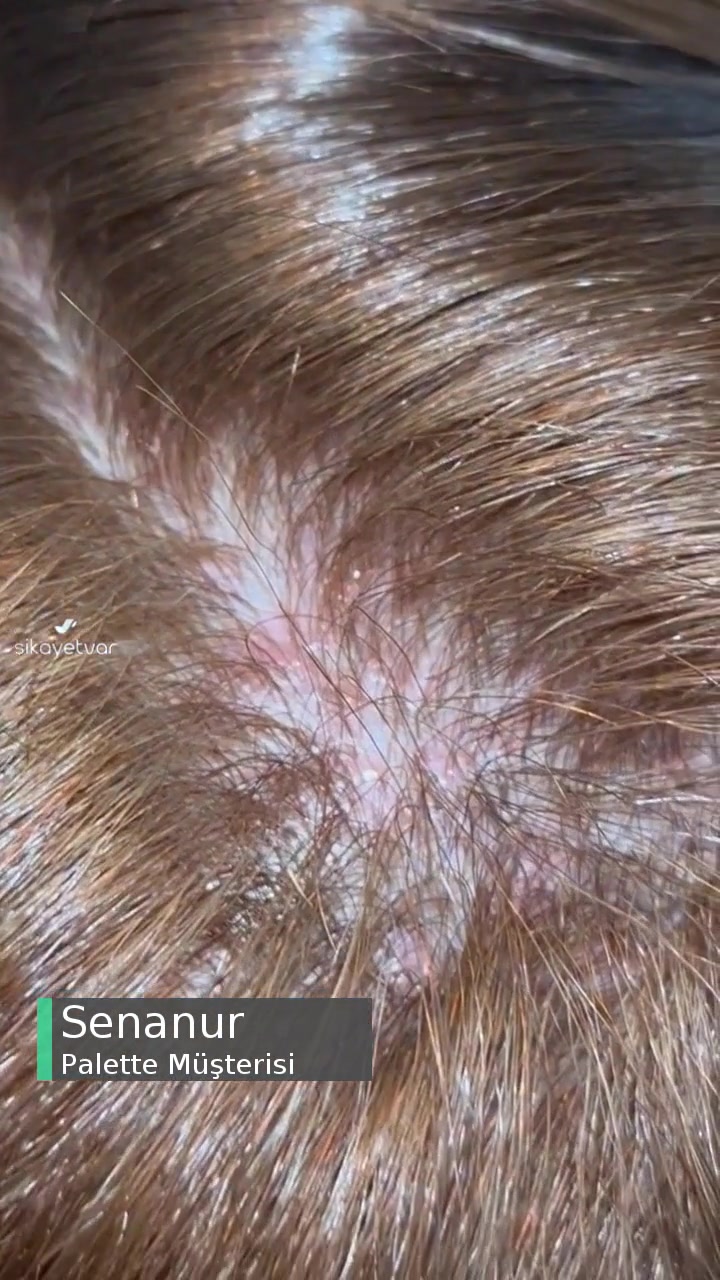 Palette Saç Boyasının Saçı 5 Dakikada Yakması! videonun kapak resmi