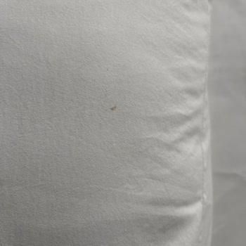 Big Termal SPA’da Kirli Çarşaflar Ve Hijyen Sorunları