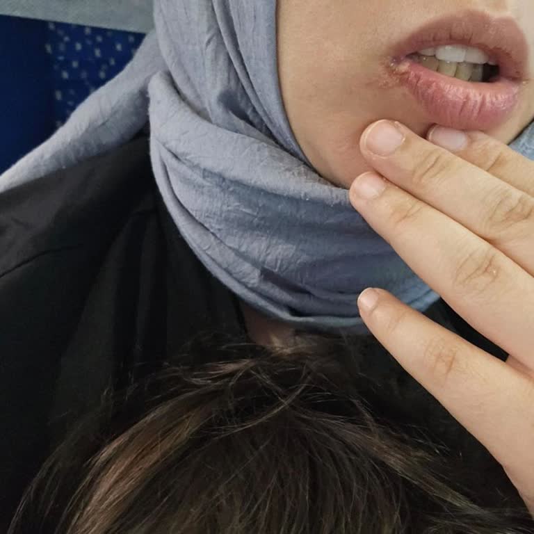 İmplant Üstü Zirkonyum Tedavisinde Sürekli Hatalı Ölçü Ve Ciddiyetsiz Yaklaşım