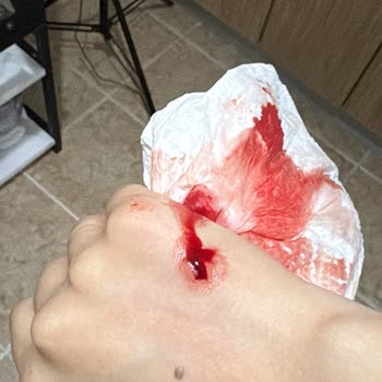 Cambu Cam Sabunluk Patlaması El Kesiklerine Ve Sağlık Riskine Yol Açtı