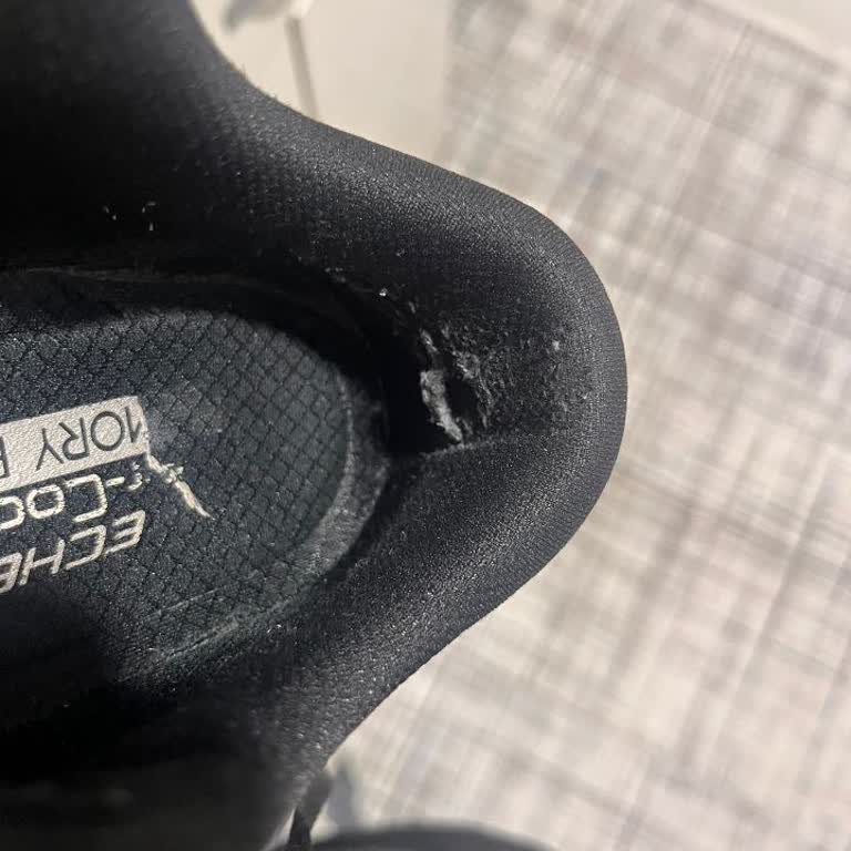 Üç Ayda Yırtılan Skechers Ayakkabı İçin Kullanıcı Hatası İddiası