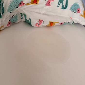 Prima Aktif Bebek 7 Numaralı Külot Bezinde Gece Sızdırma Sorunu Ve İade Talebi