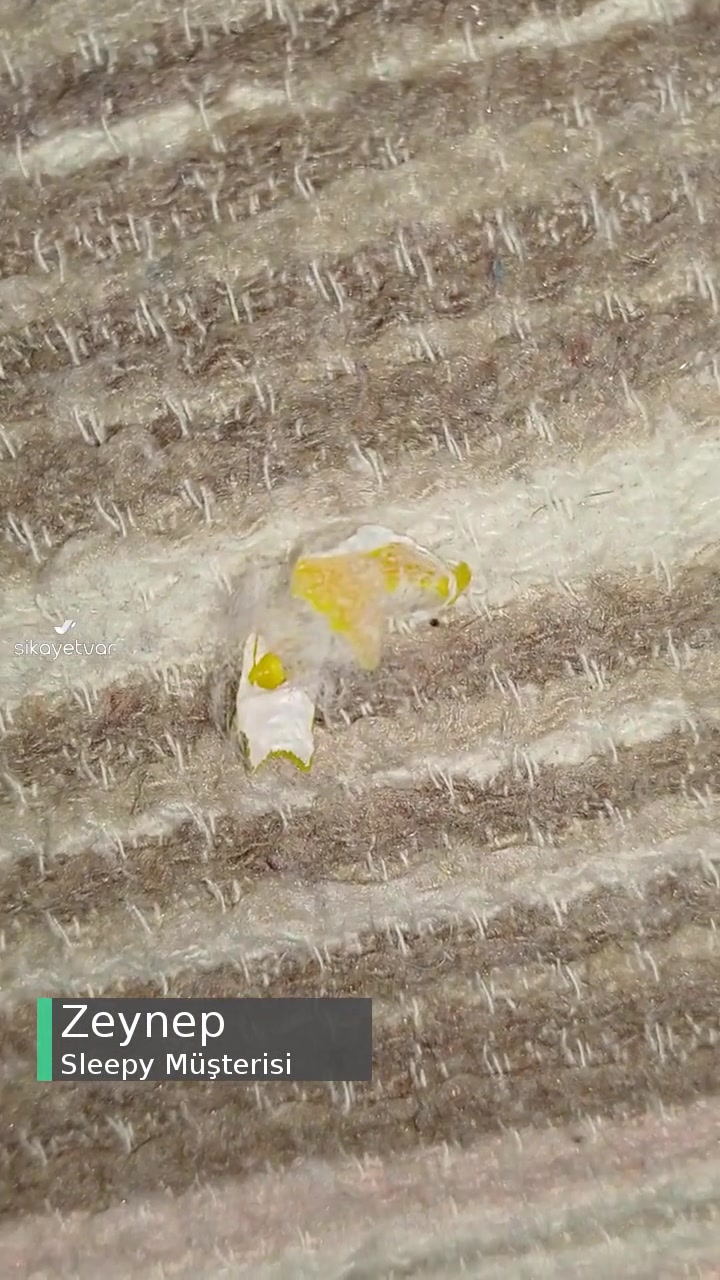 Sleepy Bebek Bezinin İçinden Sert Bir Şey Çıktı videonun kapak resmi