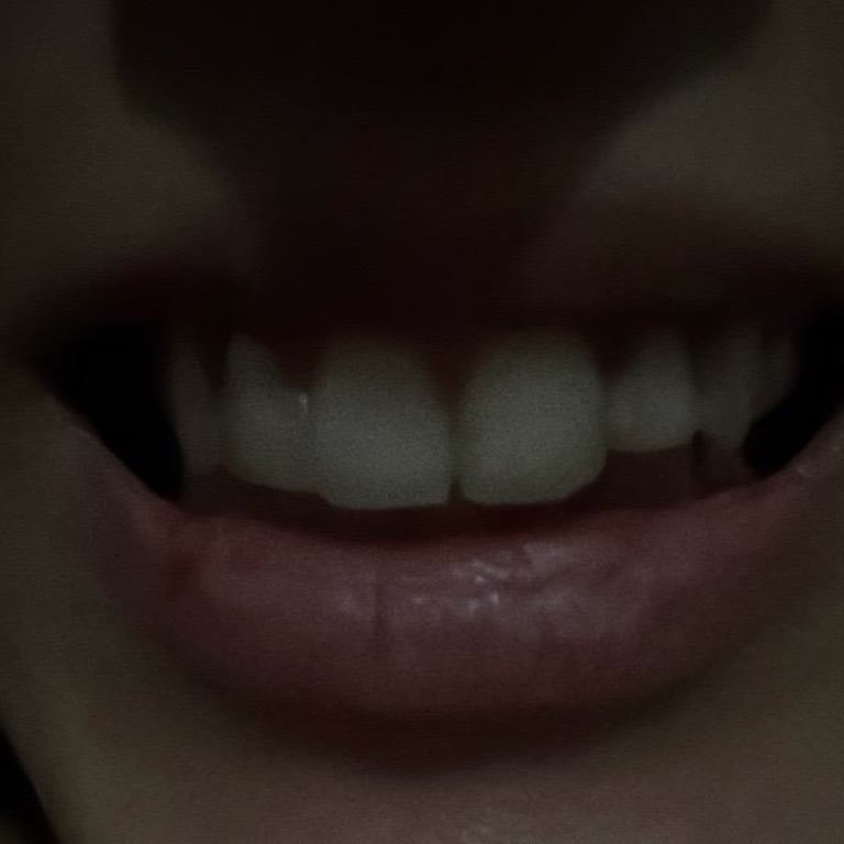 Kötü Dolgu Ve Hekimlerin Kaba Davranışı