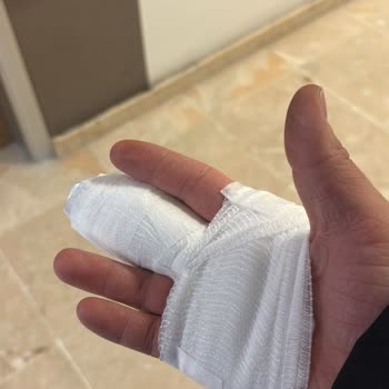 Esenler Medipol Hastanesi’nde Atel Değişimi İçin Ücret İadesi Talebi