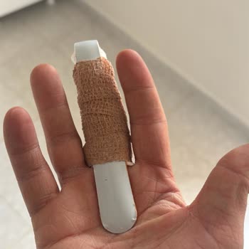 Esenler Medipol Hastanesi’nde Atel Değişimi İçin Ücret İadesi Talebi