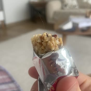 Üründe Saç Bulunması Hijyen İhlali Ve Güven Kaybı