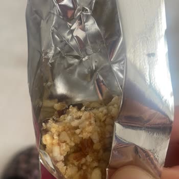 Üründe Saç Bulunması Hijyen İhlali Ve Güven Kaybı