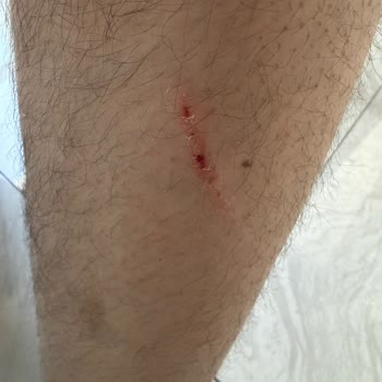 Montaj Sırasında Parke Hasarı Ve Uzayan Yatak Teslimatı