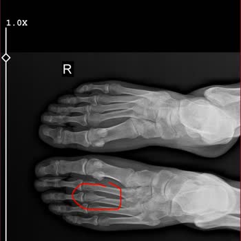 Agoda Booking Refund Request Due To Medical Emergency