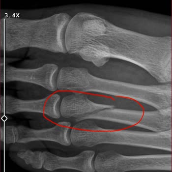 Agoda Booking Refund Request Due To Medical Emergency