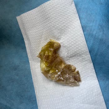 Çürük Hamburger Ve Hijyenik Olmayan Fotoğraf Talebi