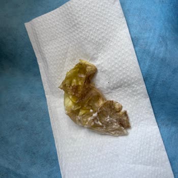 Çürük Hamburger Ve Hijyenik Olmayan Fotoğraf Talebi