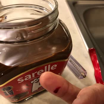 Kavanoz Kapağı Açılırken El Kesilmesi