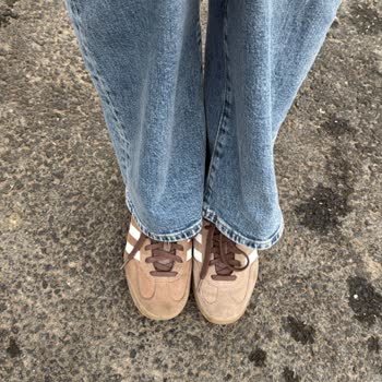 Adidas Gazelle Ayakkabısında Renk Farkı Ve Kullanıcı Hatası İddiası