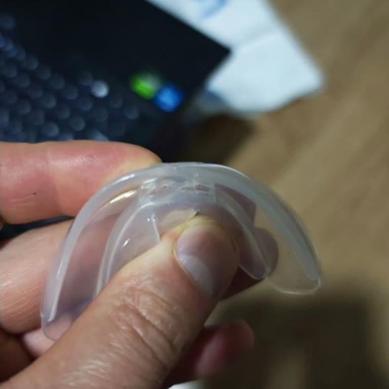 Diş Silikon Ortodontik Parantez Ağız Tepsisi Bir Günde Yırtıldı, İade Reddi