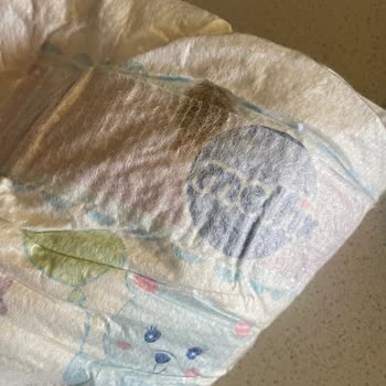 Molfix Bebek Bezinde Bilinmeyen Madde Ve Cilt Tahrişi