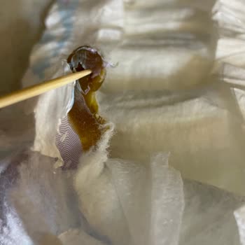 Molfix Bebek Bezinde Bilinmeyen Madde Ve Cilt Tahrişi