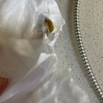 Molfix Bebek Bezinde Bilinmeyen Madde Ve Cilt Tahrişi