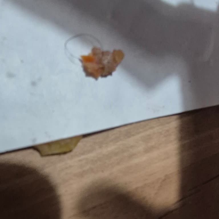 Lahmacunda Kıl Bulunması Ve İşletmenin Umursamaz Yanıtı