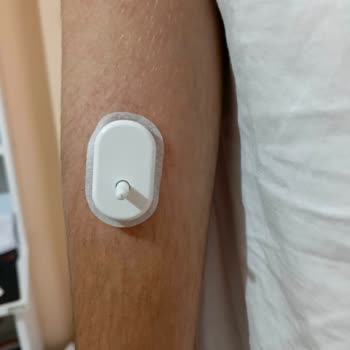 Sibionics GS1 Sensörlerinde İğne Aparatının Kolda Kalması Ve Çözüm Sunulmayan Müşteri Desteği