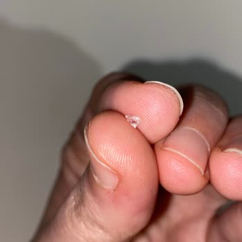 Cam Parçası İçeren Köfte Gıda Güvenliğini Tehlikeye Atıyor