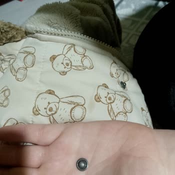 Bebek Montunda Çıkan Metal Parçadan Boğulma Tehlikesi