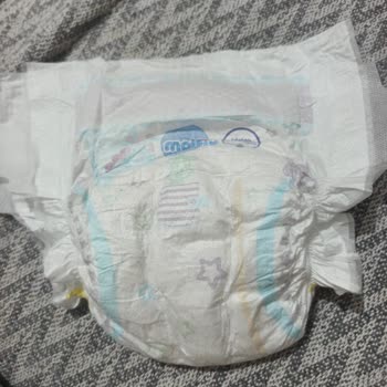 Molfix Bebek Bezlerinde Sızdırma, Parçacık Ve Bant Kopması Sorunları