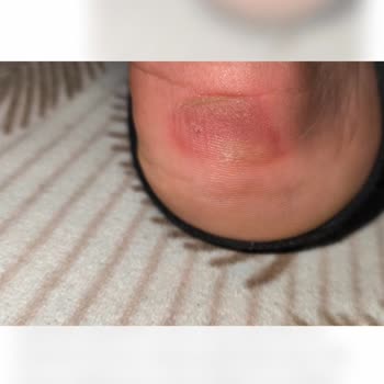 Ayıplı Spor Ayakkabının Tek Kullanımda Bozulması Ve 21 Gün Bekletilen İade Süreci