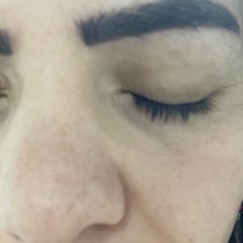 Cilt Ve Kaş İşlemlerinde Profesyonellik Eksikliği Ve Ücret İadesi Talebi