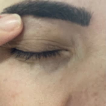 Cilt Ve Kaş İşlemlerinde Profesyonellik Eksikliği Ve Ücret İadesi Talebi