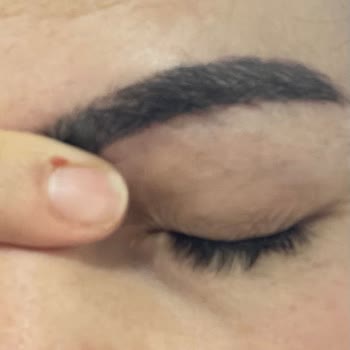 Cilt Ve Kaş İşlemlerinde Profesyonellik Eksikliği Ve Ücret İadesi Talebi