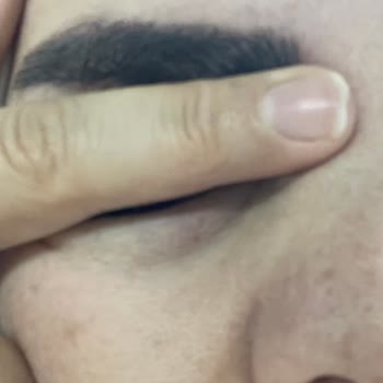 Cilt Ve Kaş İşlemlerinde Profesyonellik Eksikliği Ve Ücret İadesi Talebi