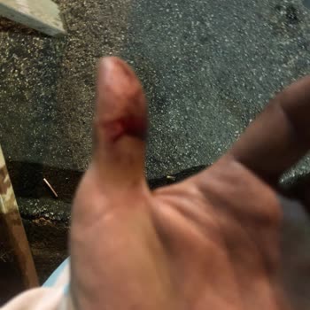 Acil Serviste Şiddetli Tedavi İhmali Ve Personel İlgisizliği