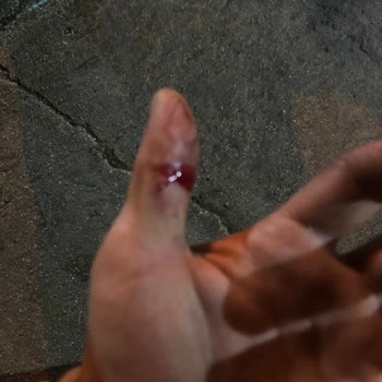 Acil Serviste Şiddetli Tedavi İhmali Ve Personel İlgisizliği