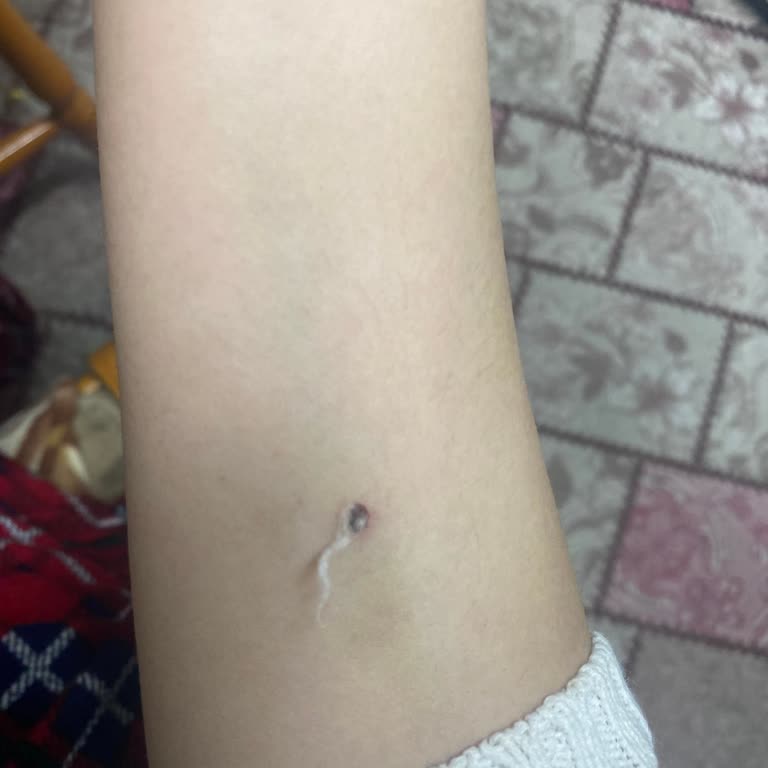 Bakır Saçlı Hemşire Damarı Patlattı Ve Şiddetli Acı Çektirdi