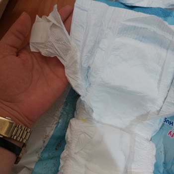 Molfix Bebek Bezinde Çırt Çırt Yokluğu Kullanılamaz Ürün Şikayeti