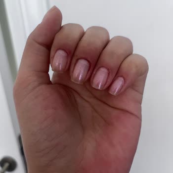 Hijyenik Olmayan Manikür Sonrası Tırnak Diplerinde Şiddetli İltihap